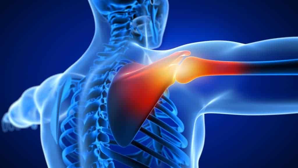 Shoulder Pain After Car Accident