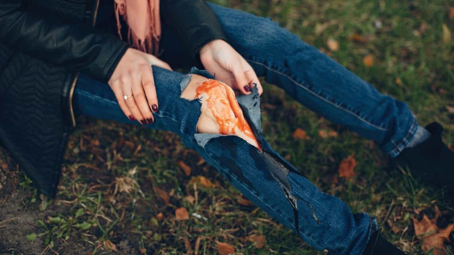 Treating Road Rash From a Motorcycle Accident