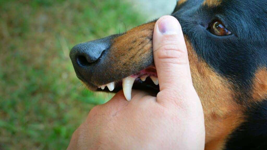Dog Bite Victim: Steps to Take After a Dog Attack