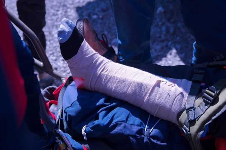 Person with a leg cast receiving first aid assistance outdoors after an injury, illustrating a scenario that could lead to a personal injury claim